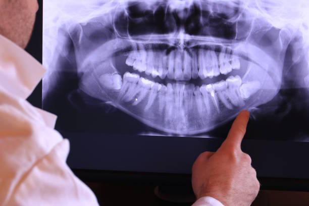 Best Broken or Cracked Tooth Emergency Dentist in Cherryland, CA
