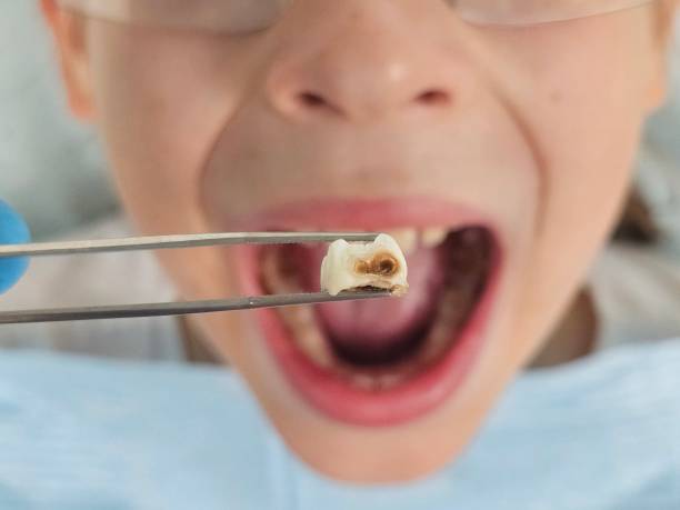 Best Orthodontic Emergency Dentist in Cherryland, CA